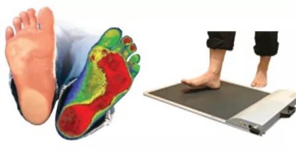 πελματογράφημα-ποδολογικό-αγρίνιο